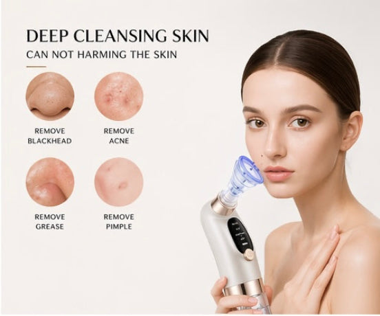 DermaVac Elite™ – Advanced Blackhead Remover