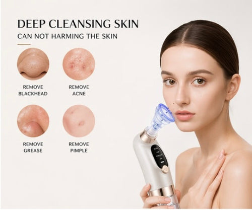 DermaVac Elite™ – Advanced Blackhead Remover