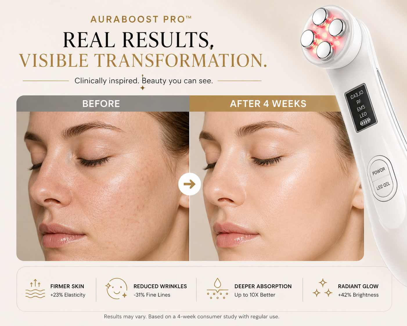 AuraBoost Pro™ – 5-in-1 RF EMS Skin Booster